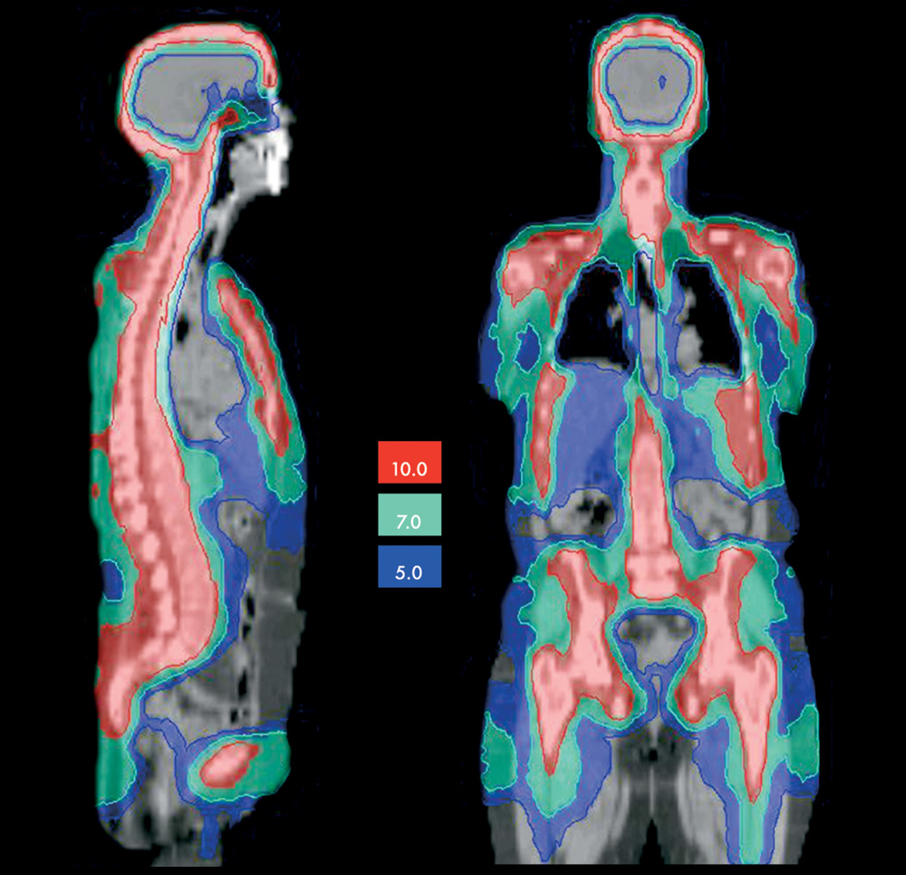 The Congressional Research Service compared CT Checkpoint Screening technology with 2D X-Ray and concluded that CT had big advantages: higher throughput, better threat detection, and automated threat detection.