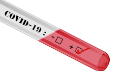 Covid 19 4908690 1280 5e94bd0cf2344 Covid 19 4908690 1280 5e94bd0cf2344