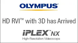 Hd Rvi Has Arrived