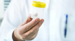 A person wearing a white lab coat holding an empty clear sample cup with a yellow lid